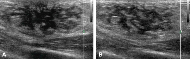 Fig. 4
