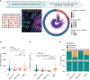 Figure 2. TNBCs display high tumor-specific MHC-I expression heterogeneity. A, mIF for HLA-A/B/C and panCK was performed on 295 breast tumors in tissue microarray format (n = 227 ER+; 9 HER2+/ER+; 7 HER2+/ER−; 52 TNBC) to obtain single-cell resolution MHC-I expression. The circle plot is a summary of the patients’ HLA-A/B/C expression. Each line in the center represents single patient tumors comprised of individual tumor cell HLA-A/B/C expression plotted as a dotted plot. Spikes are colored by the tumor's mean MHC-I intensity. The inner layer of the circle reflects the coefficient of variation of each tumor. The outer layer of the circle is labeled by breast cancer subtype. B, Total sample HLA-A/B/C IF intensity across breast cancer subtypes. C, Coefficient of variation of HLA-A/B/C expression within breast tumors. D, Hartigan's dip test was applied to determine whether the distribution of tsMHC-I expression is unimodal or multimodal. ****, P < 0.0001; **, P < 0.01; ns, not significant. Bonferroni-corrected t test was used for statistical comparisons. Box plots display the median, 25th, and 75th quantiles.