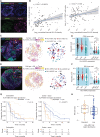 Figure 7. Tumor-specific MHC-I expression is associated with the regional NK-cell and T-cell infiltration. A, mIF for HLA-E and panCK (merged and single channel example shown) was performed on 93 TNBC tumor microarrays. B, The expression HLA-E on tumor cells positively correlates with NK-cell and CD8 T-cell abundance. P = 0.00078, Spearman test. Log10 normalization was performed on HLA-E intensity, CD8 T-cell counts, and NK-cell counts to improve visualization. C, Representative mIF staining for DAPI, panCK, HLA-A/B/C, and CD8 or CD56. Cell identity, spatial coordinates, and HLA-A/B/C expression were recorded for subsequent analysis of the tumor microenvironment. Tumor cells were further clustered with the DBSCAN algorithm to capture spatial tumor islands and the islands were labeled based on their MHC-I expression. Scale bar, 10 µm. D, CD8 T cells were clustered with their nearest tumor island to form a CD8–tumor pair. Box plot showing the average of adjusted CD8–tumor pair count per patient; ****, P < 0.0001; ***, P < 0.001; Bonferroni-corrected paired t test, ROI = 154. E, NK cells were clustered with their nearest tumor island to form NK–tumor pair. F, Box plot showing average of adjusted NK–tumor pair count per patient. *, P < 0.05, Bonferroni-corrected paired t test, ROI = 69. Scale bar, 10 µm. G, Patients from the NCT03206203 clinical trial were classified as HLA-A/B/Chet region dominant (labeled as abundant) or HLA-A/B/Chet region low (labeled as low). PFS was compared using the log-rank test between the two cohorts within carboplatin + atezolizumab arm (n = 41, P = 0.00071) and carboplatin arm (n = 39, P = 0.14). Confidence intervals for the corresponding patients were represented as yellow or blue dotted line and median survival for each cohort is plotted as a black dotted line. H, Normalized NK: CD8 cell ratio was calculated based on gene expression-imputed CD8 and NK cell abundance. *, P < 0.05, Wilcoxon test. All the box plots capture the median, and 25th and 75th quantile.