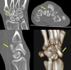 Fig. 2