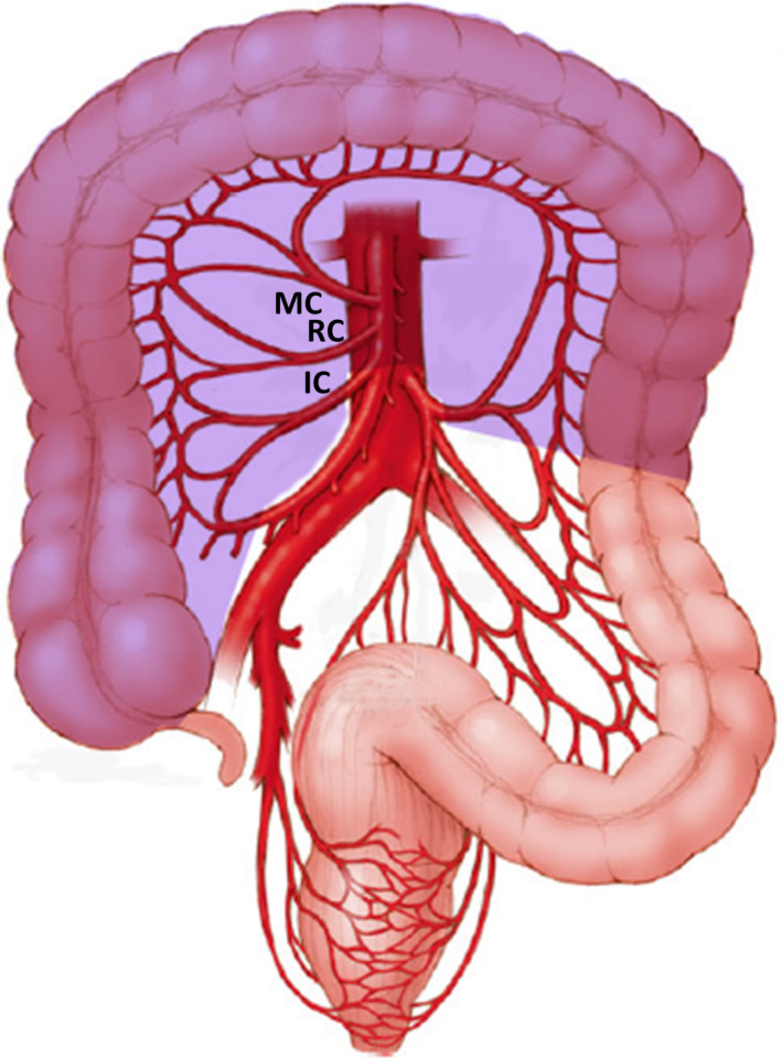 FIGURE 3