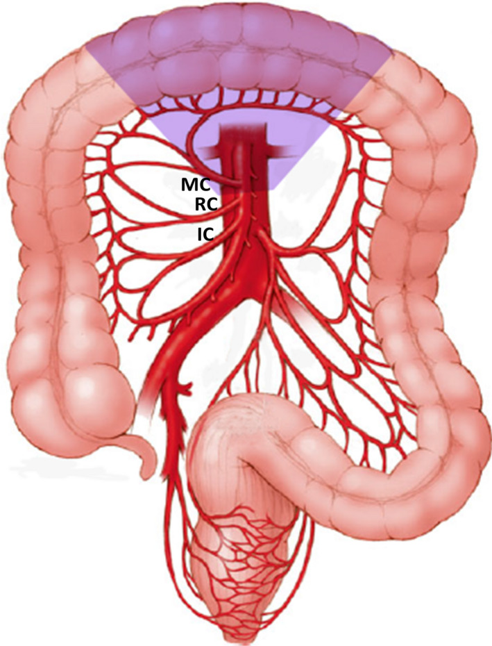 FIGURE 2