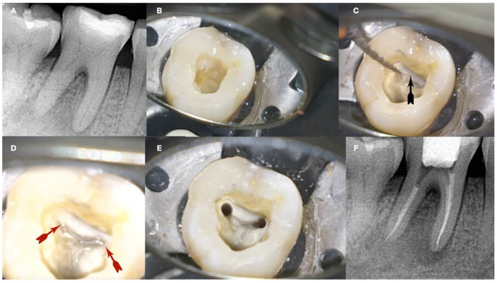 Figure 13