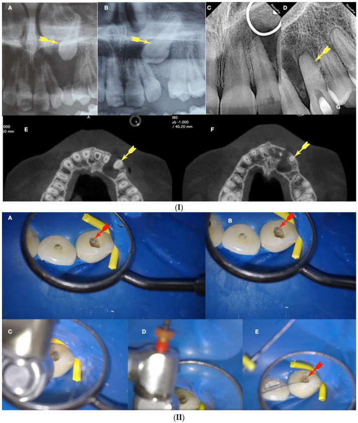 Figure 11