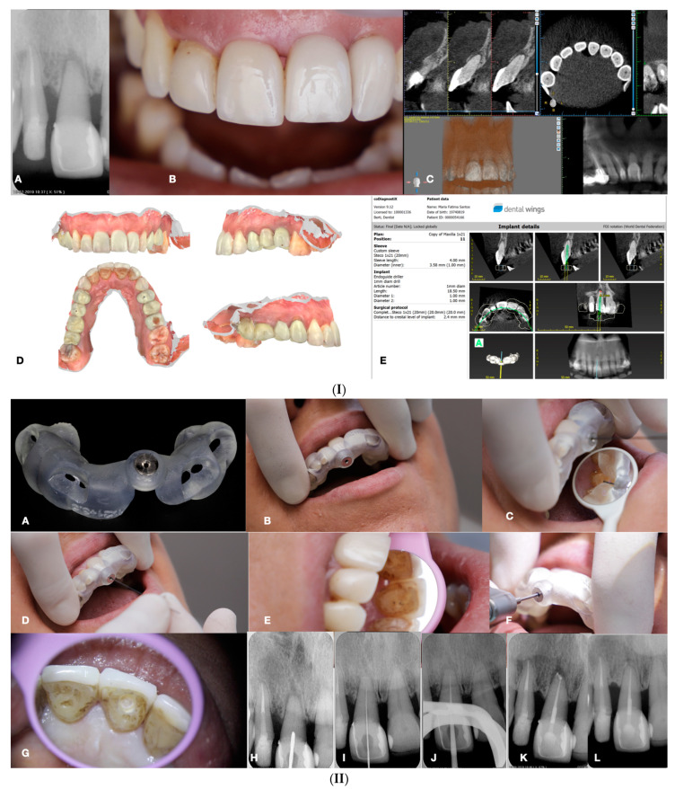 Figure 15