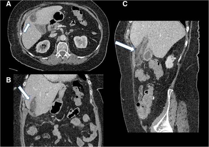 Fig. 14
