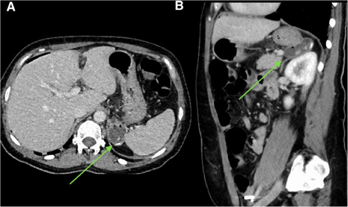 Fig. 24
