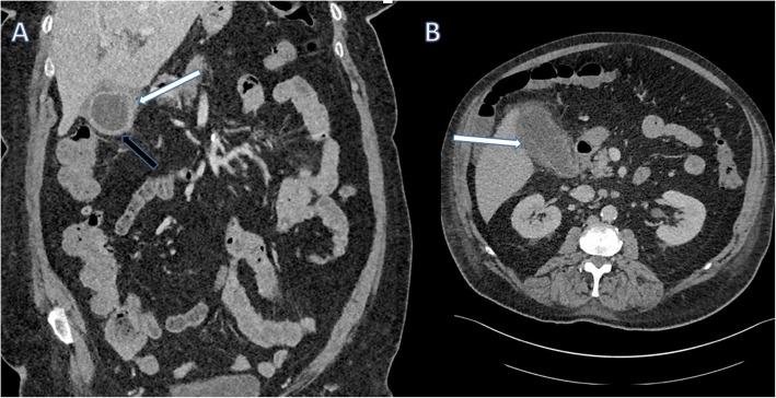 Fig. 10