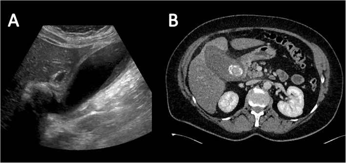 Fig. 17