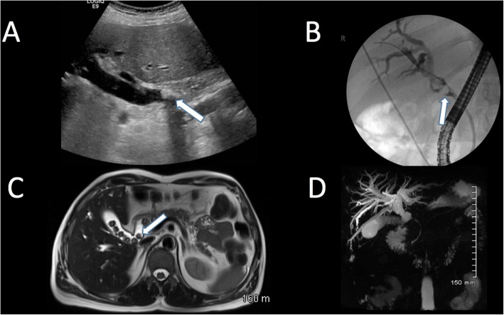 Fig. 19