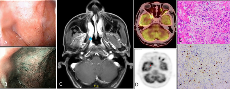 Figure 1