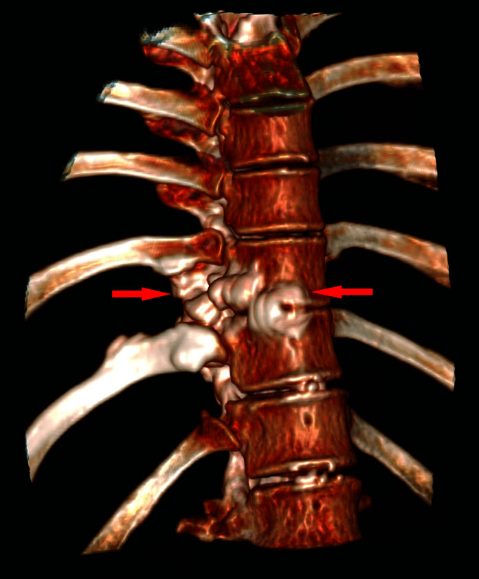 Figure 1D: