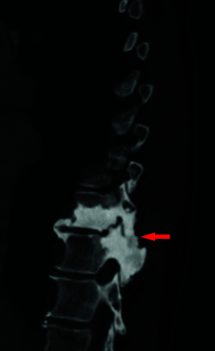 Figure 1C: