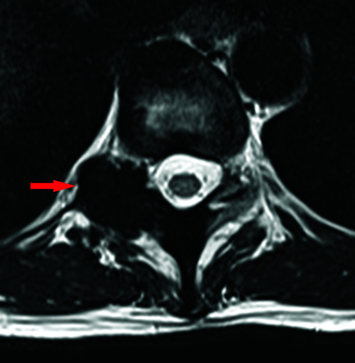 Figure 1G: