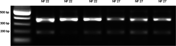 FIGURE 12