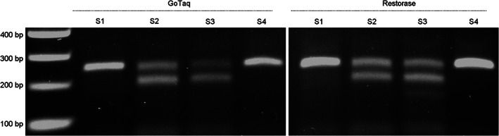 FIGURE 11