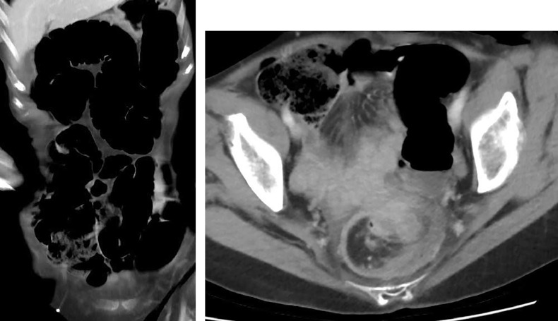 Fig. 2 –