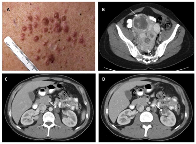 Fig. 4