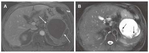 Figure 18