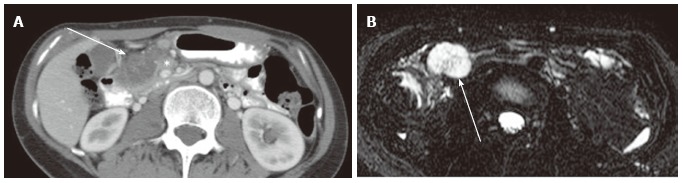 Figure 17