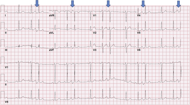Figure 2