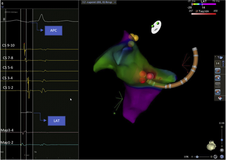 Figure 3