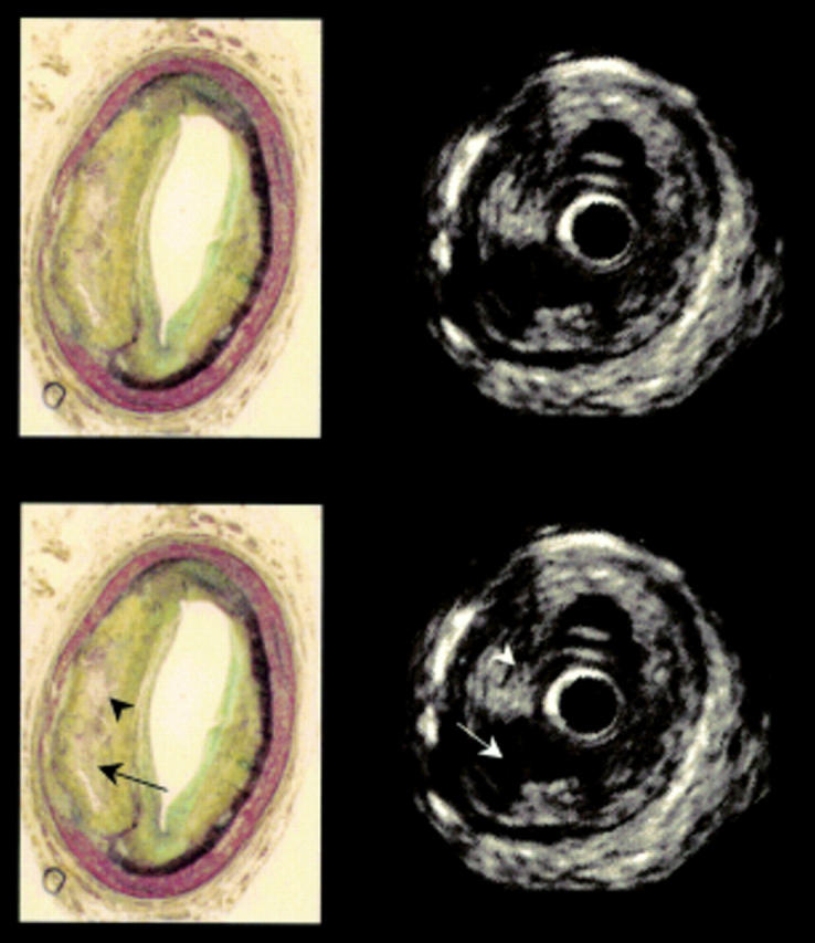 Figure 2  