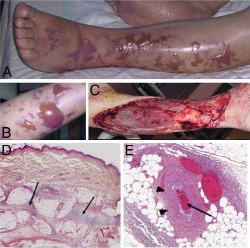 FIG. 1.