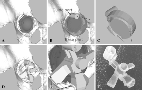 Fig. 1A–F