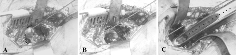 Fig. 2A–C