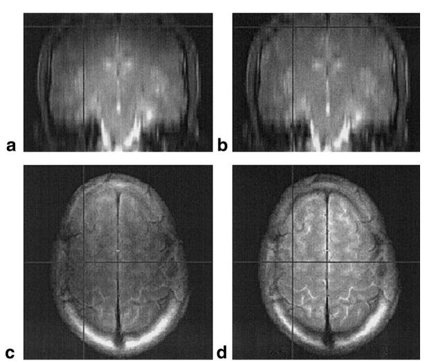 FIG. 11