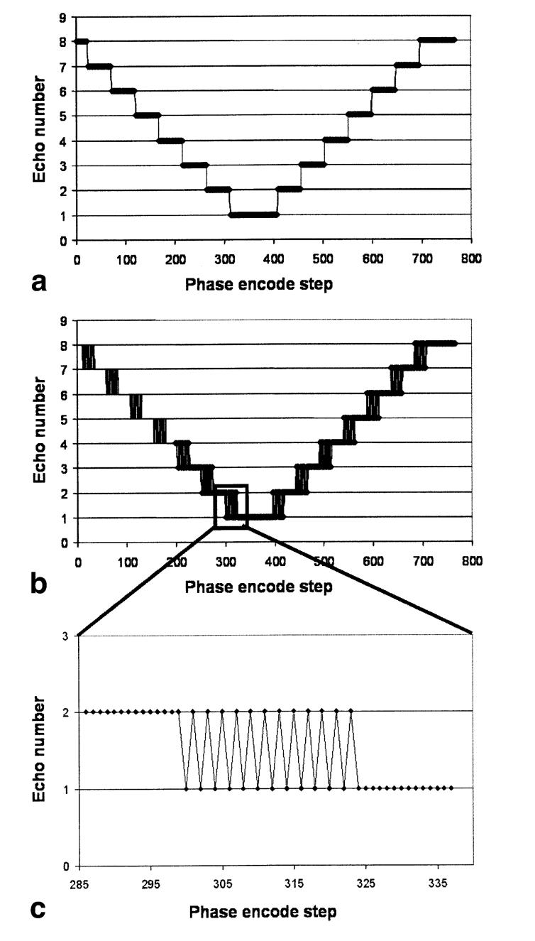 FIG. 1