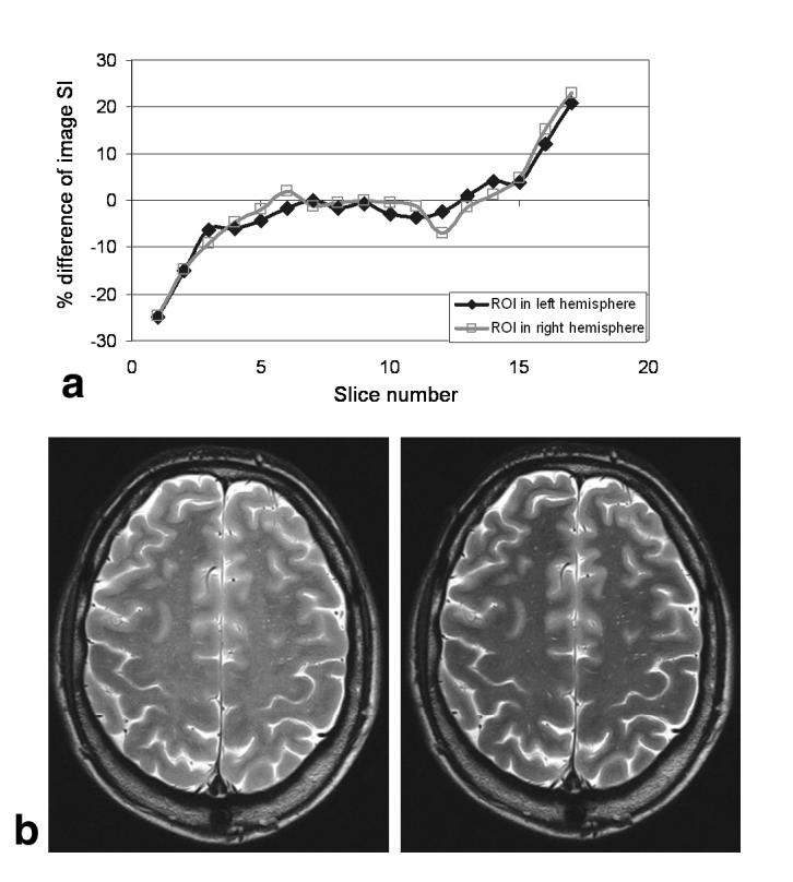 FIG. 9