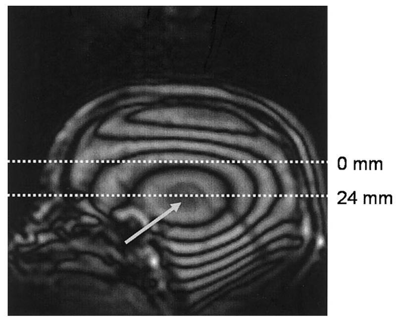 FIG. 10