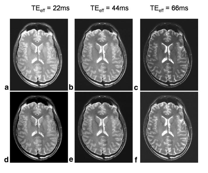 FIG. 8