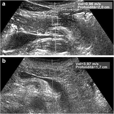 Fig. 13