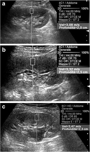 Fig. 12