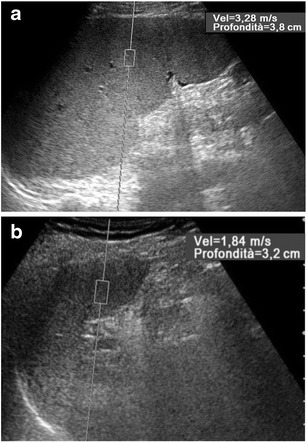 Fig. 11