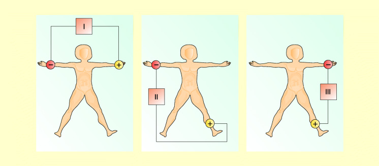 graphic file with name 6376_9_De_47_Fig6_HTML.jpg
