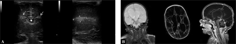 Fig. 14