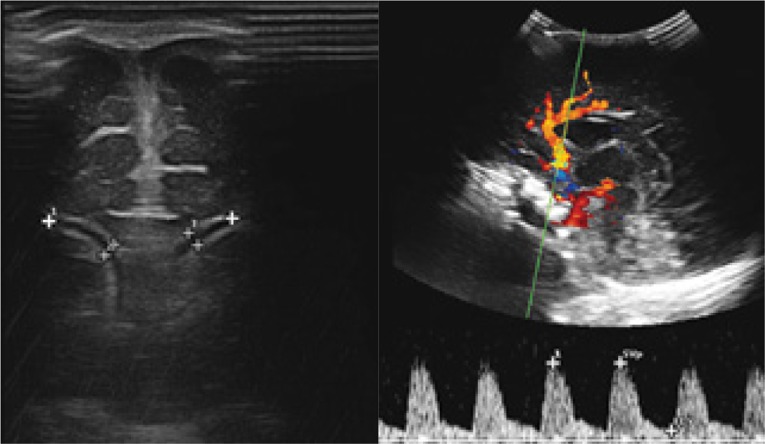 Fig. 12