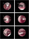 Fig. 2