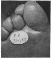 147