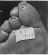 147