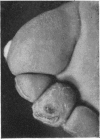 146