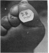 147