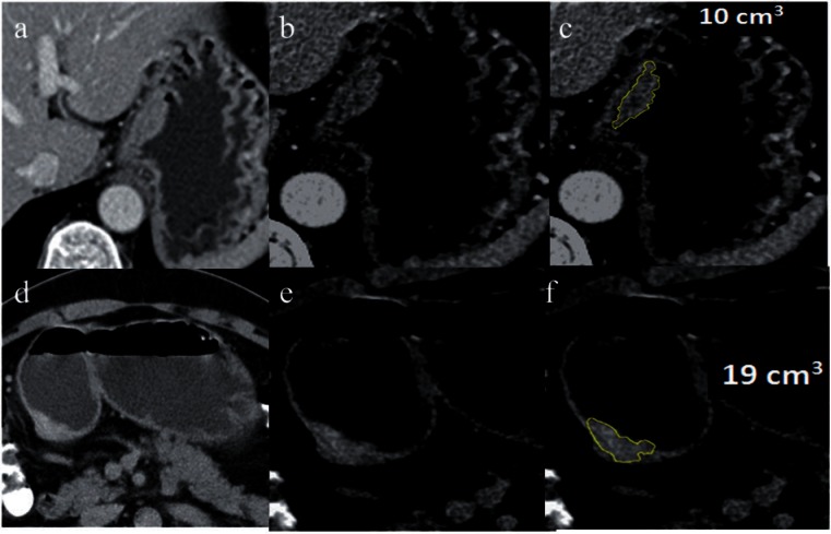 Figure 12