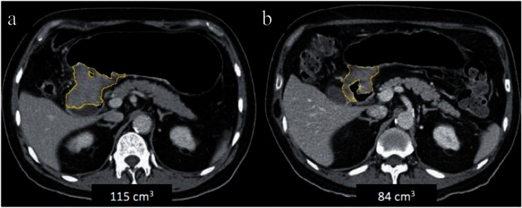 Figure 11