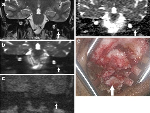 Fig. 11