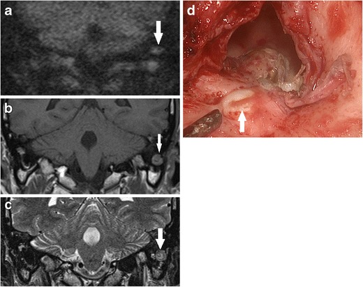 Fig. 14